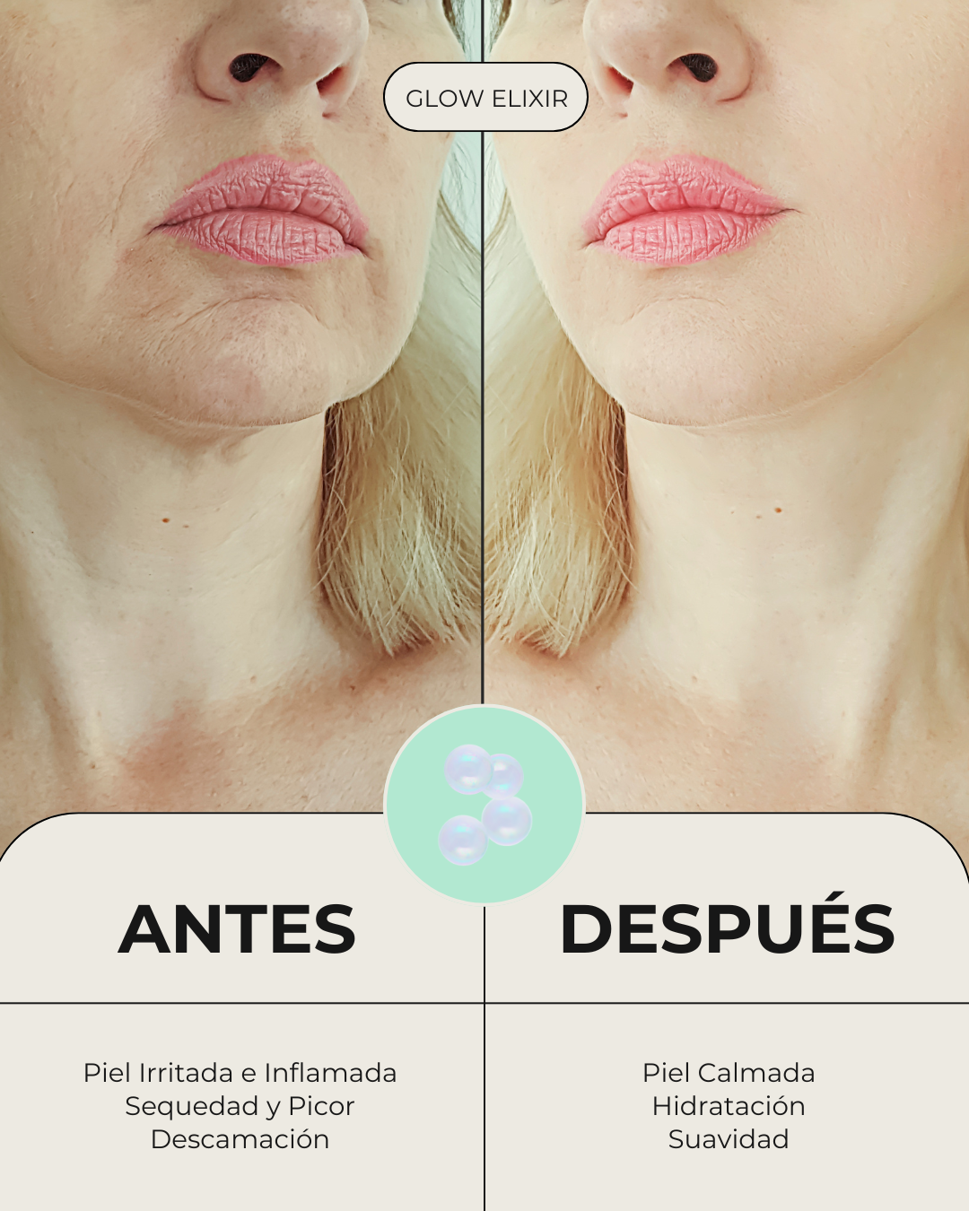 Comparativa de antes y después del uso del sérum iluminador Glow Elixir. Muestra el cambio de una piel irritada, seca y con descamación a una piel calmada, suave, hidratada y visiblemente rejuvenecida.