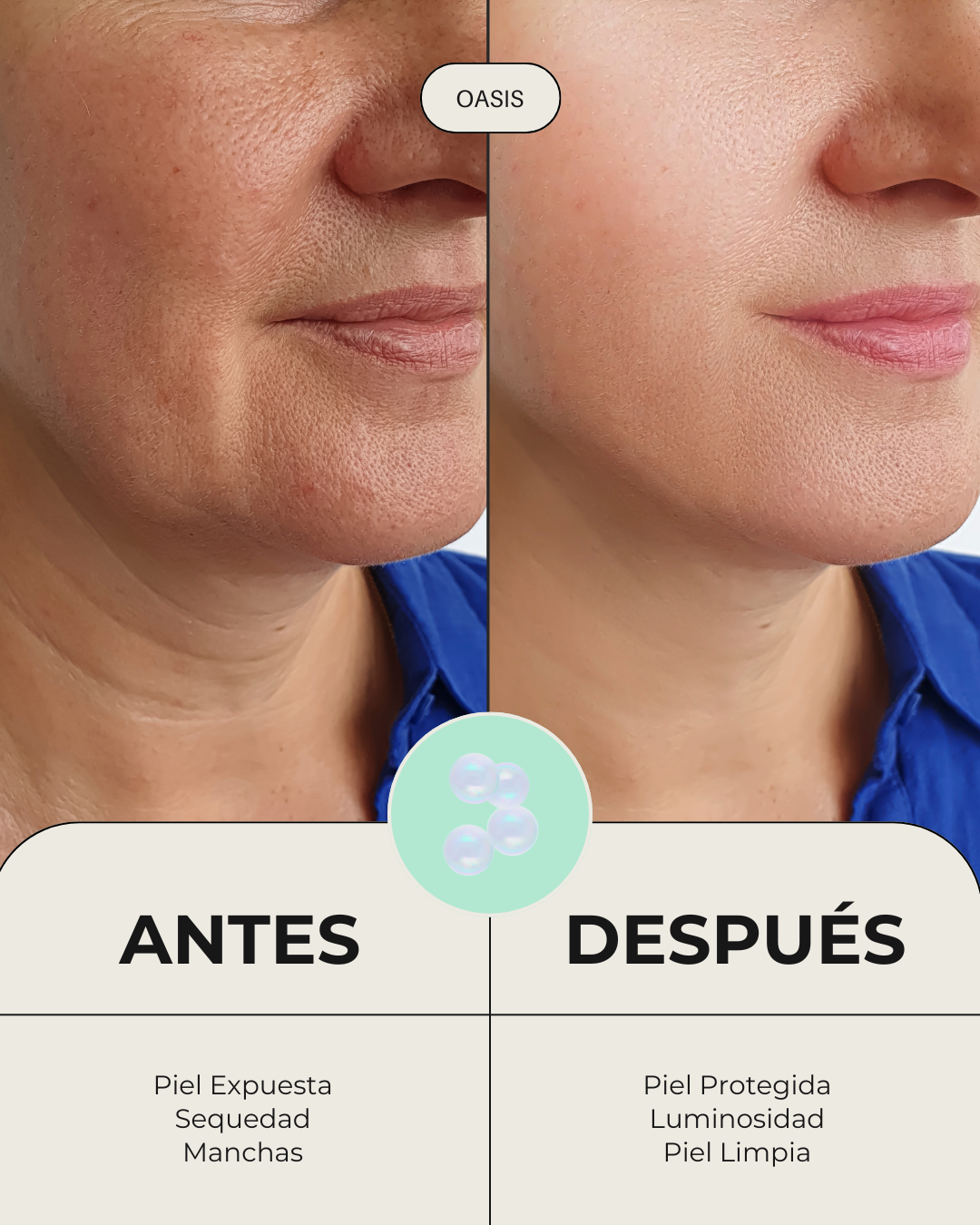Comparativa de antes y después utilizando el sérum antimanchas y serum antiarrugas Oasis. Muestra la evolución de una piel expuesta, con sequedad y manchas, hacia un rostro visiblemente más protegido, limpio, luminoso y con líneas de expresión suavizadas.